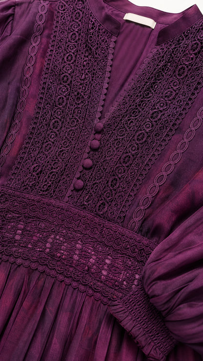 Close-up detail of lace neckline, covered buttons, and smocked waist texture